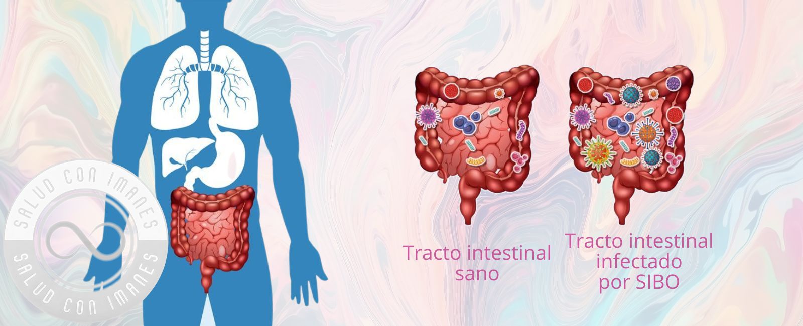 Tratamiento del SIBO con Par Biomagnético | Causas y Soluciones