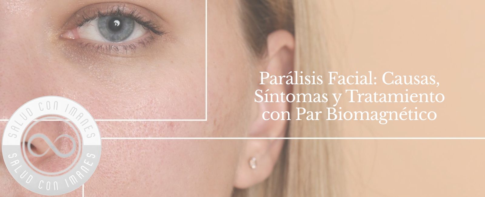 Parálisis Facial: Causas, Síntomas y Tratamiento con Par Biomagnético